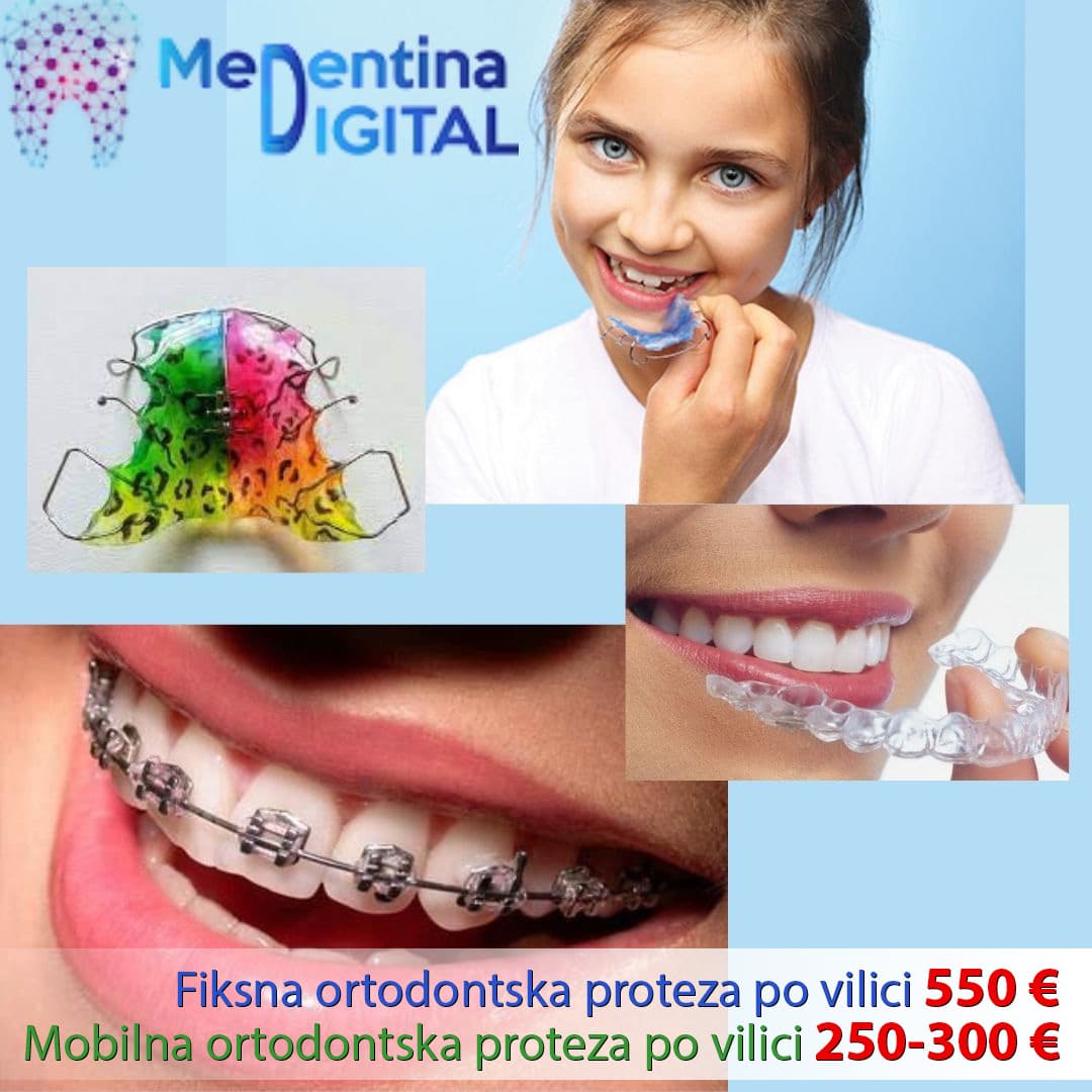 https://medentinadigital.rs/wp-content/uploads/2019/03/Fiksna-i-mobilna-ortodontska-proteza-po-vilici.jpeg