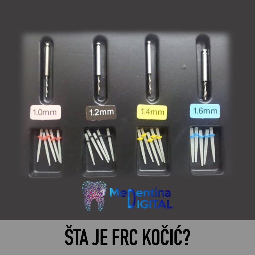 Šta je FRC kočić?