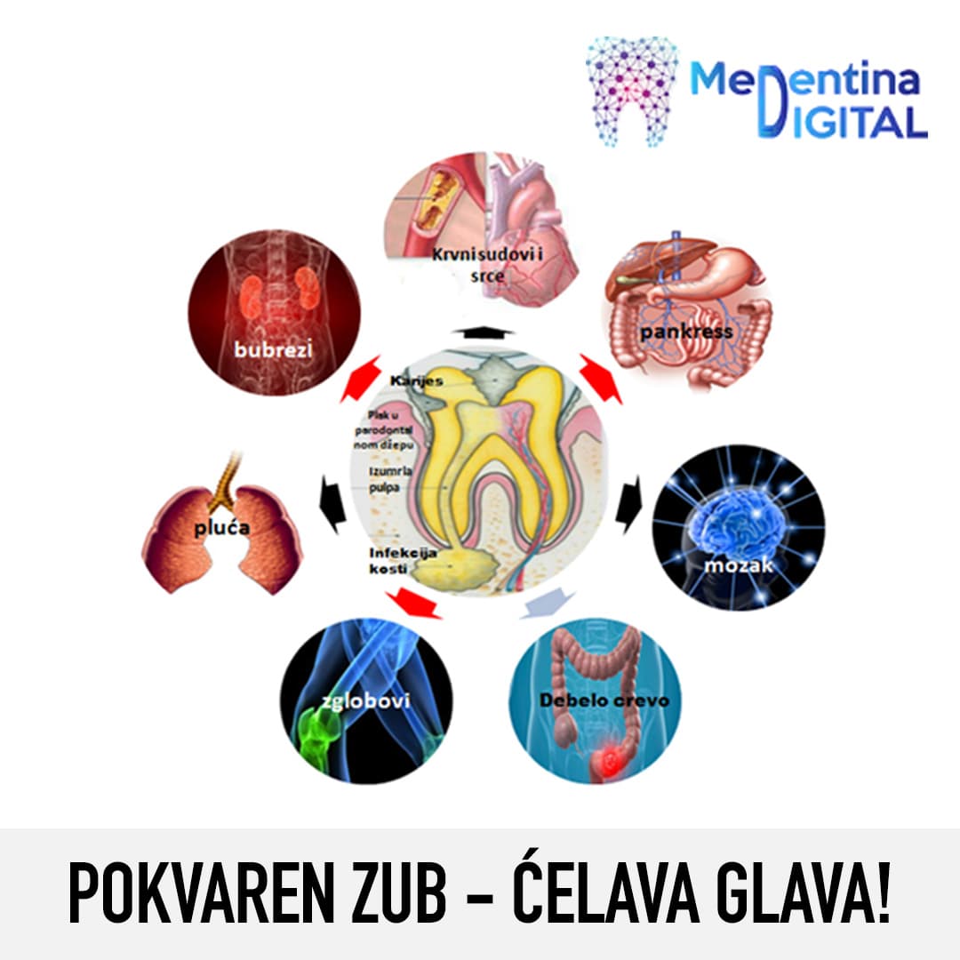 Pokvaren zub – ćelava glava!