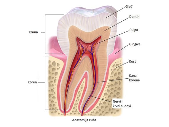 Slika 1. Karijes zuba