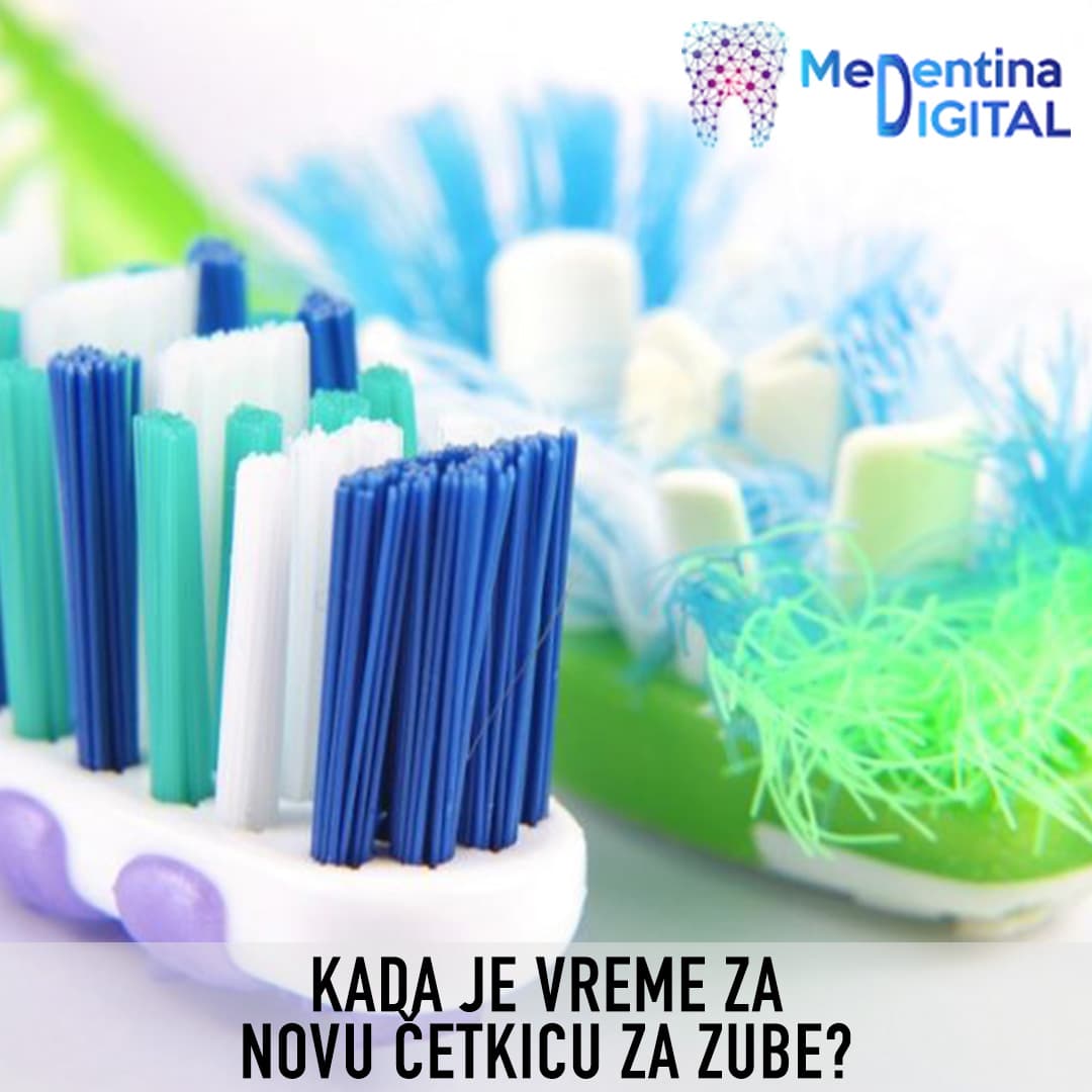 Kada je vreme za novu četkicu za zube?