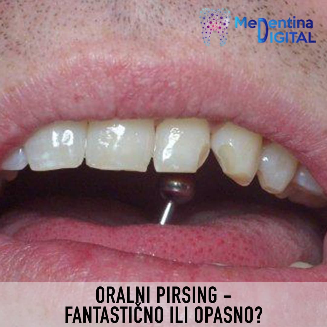 Oralni pirsing – fantastično ili opasno?