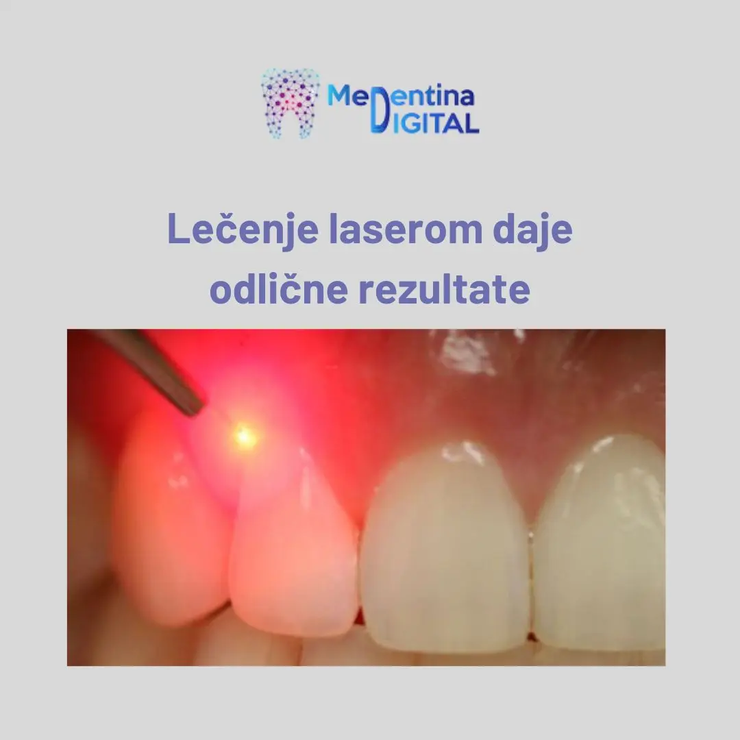 Simptomi i lecenje parodontopatije 3 https://medentinadigital.rs/wp-content/uploads/2025/03/Simptomi-i-lecenje-parodontopatije-3.webp