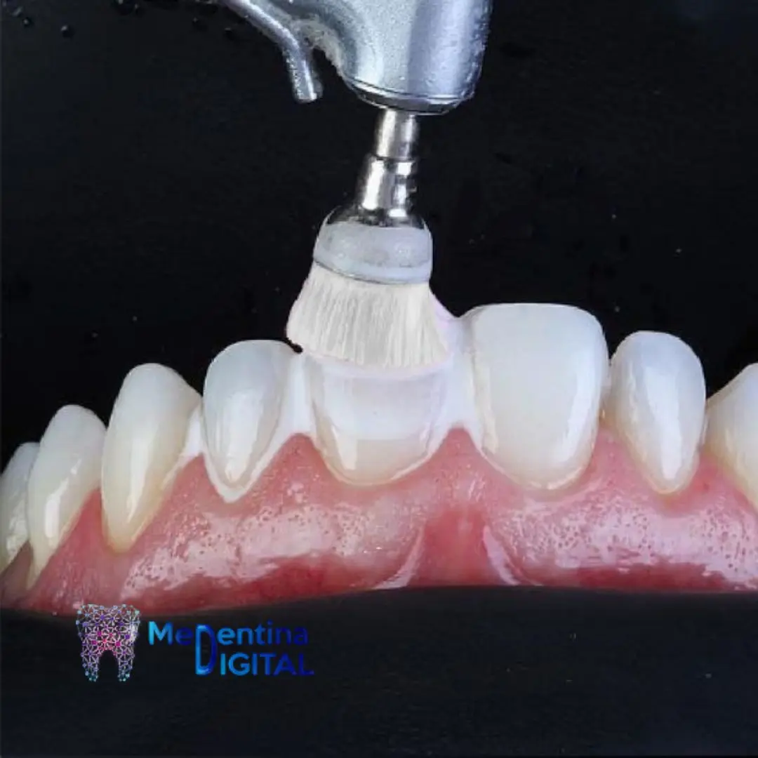 Sta je zubni kamenac 3 https://medentinadigital.rs/wp-content/uploads/2025/03/Sta-je-zubni-kamenac-3.webp